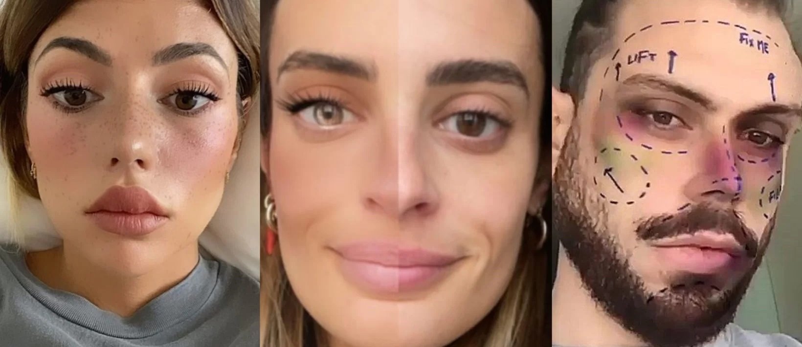 Se nos va de las manos lo de los selfies y los filtros…